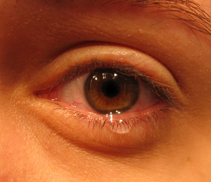 Irritação nos olhos, ardência, coceira ou vermelhidão? – Revista Sou